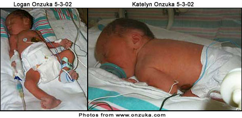 The new Onzuka Twins